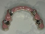 オールオン４で使用する固定の歯