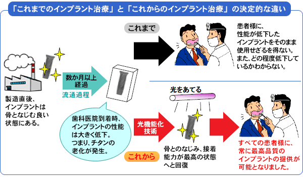 「これまでのインプラント治療」と「これからのインプラント治療」の決定的な違い