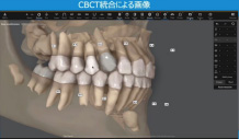 CBCT統合による画像